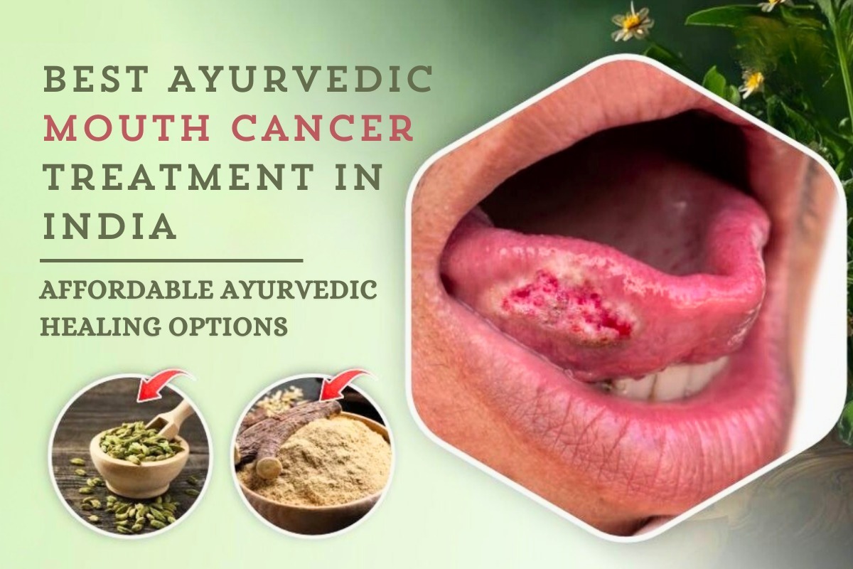 Best Ayurvedic Mouth Cancer Treatment in India: Affordable Ayurvedic Healing Options