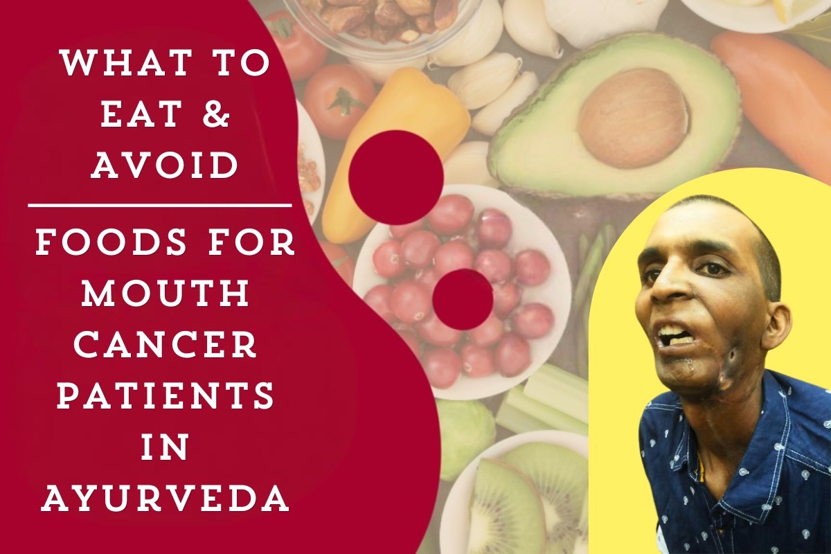 What to Eat & Avoid: Foods for Mouth Cancer Patients in Ayurveda